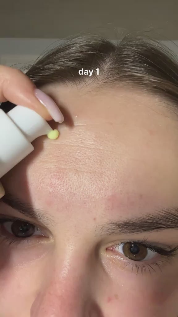 K - SECRET Seoul 1988 Serum: Retinal Liposome 2% + Black Ginseng - 30ml | ك سيكريت سيروم ريتينال وجينسينغ - 30 مل