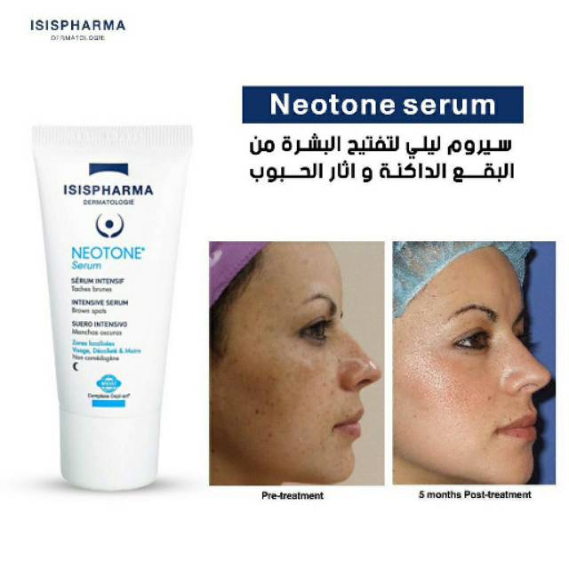 ISIS PHARMA NEOTONE SERUM - 30 ML | ايزيس فارما سيروم مركز ضد التصبغات - 30 مل