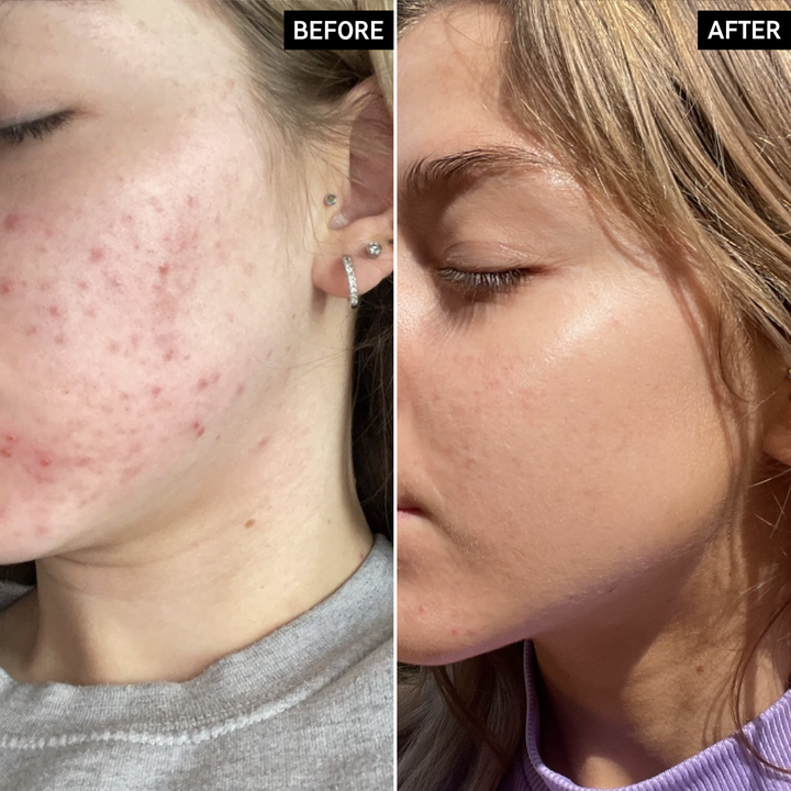 The Inkey List Niacinamide Serum For All - 30ml | ذا انكي ليست سيروم النياسيناميد للجميع - 30 مل