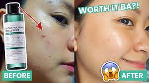 Some By Mi AHA. BHA. PHA 30Days Miracle Toner  - 150ml | سوم باي مي تونر مقشر بالاحماض للوجه - 150 مل