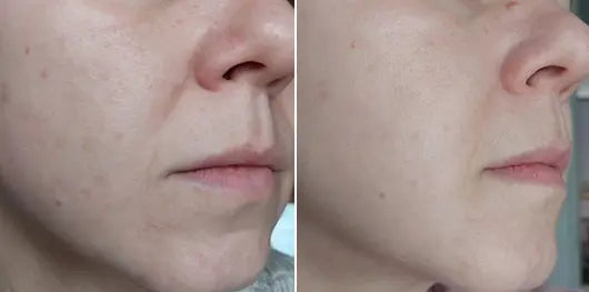 Pixi Retinol Tonic | بيكسي تونر ريتينول