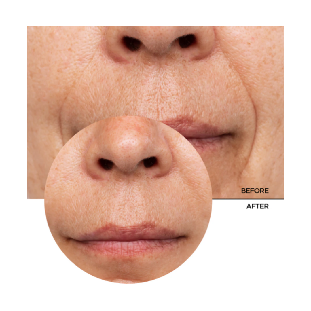 REVOX Just Retinol facial serum - 30ml | ريفوكس سيروم الرتينيول - 30 مل