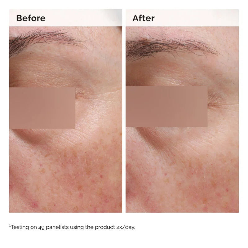 The Ordinary Niacinamide 5% Face and Body Emulsion - 100ml| ذا أورديناري مستحلب النياسيناميد للوجه والجسم 5%  -100مل