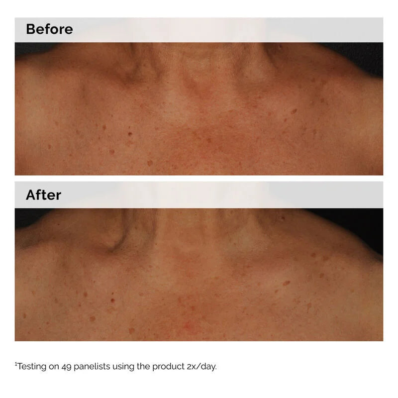 The Ordinary Niacinamide 5% Face and Body Emulsion - 100ml| ذا أورديناري مستحلب النياسيناميد للوجه والجسم 5%  -100مل