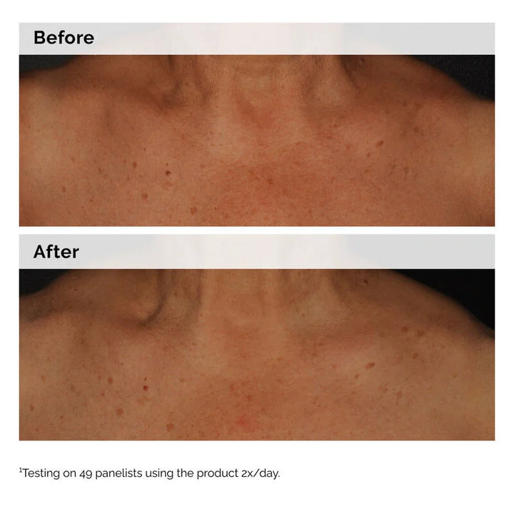 The Ordinary Niacinamide 5% Face and Body Emulsion - 100ml| ذا أورديناري مستحلب النياسيناميد للوجه والجسم 5%  -100مل