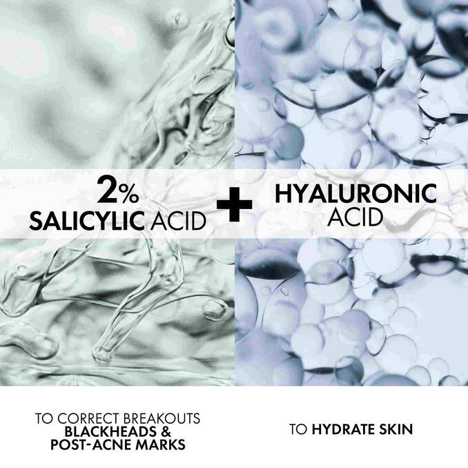 VICHY Normaderm Acne-Prone Skin - 50ml | فيشي كريم للبشرة المعرضة لحب الشباب - 50 مل