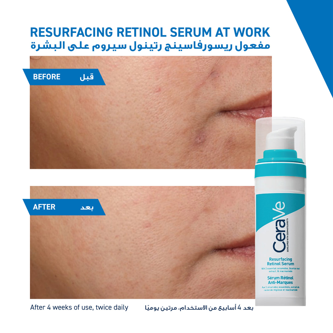 CERAVE RESURFACING RETINOL SERUM TO REDUCE THE APPEARANCE OF POST-ACNE MARKS AND PORES WITH RETINOL, LICORICE ROOT EXTRACT & NIACINAMIDE - 30ml | سيرافي سيروم ريتنول - 30 مل