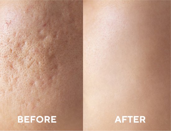 the CEEL Charcoal Serum Aha + Bha Charcoal Niacinamide - 30ml |  AHA + BHA - 30  ذا سيل سيروم الفحم والنياسيناميد مل