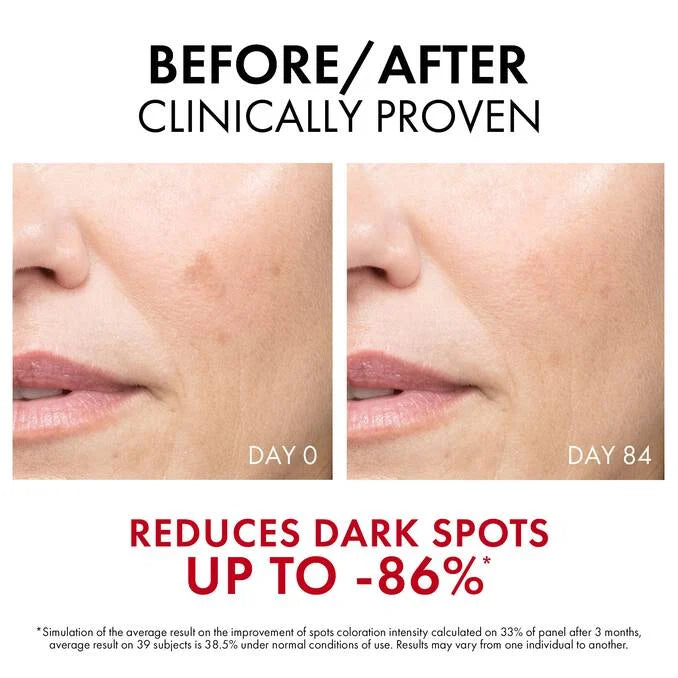 VICHY Lift Active B3 Serum Dark Spots & Wrinkles - 30ml | فيشي سيروم مضاد للبقع و التجاعيد - 30 مل