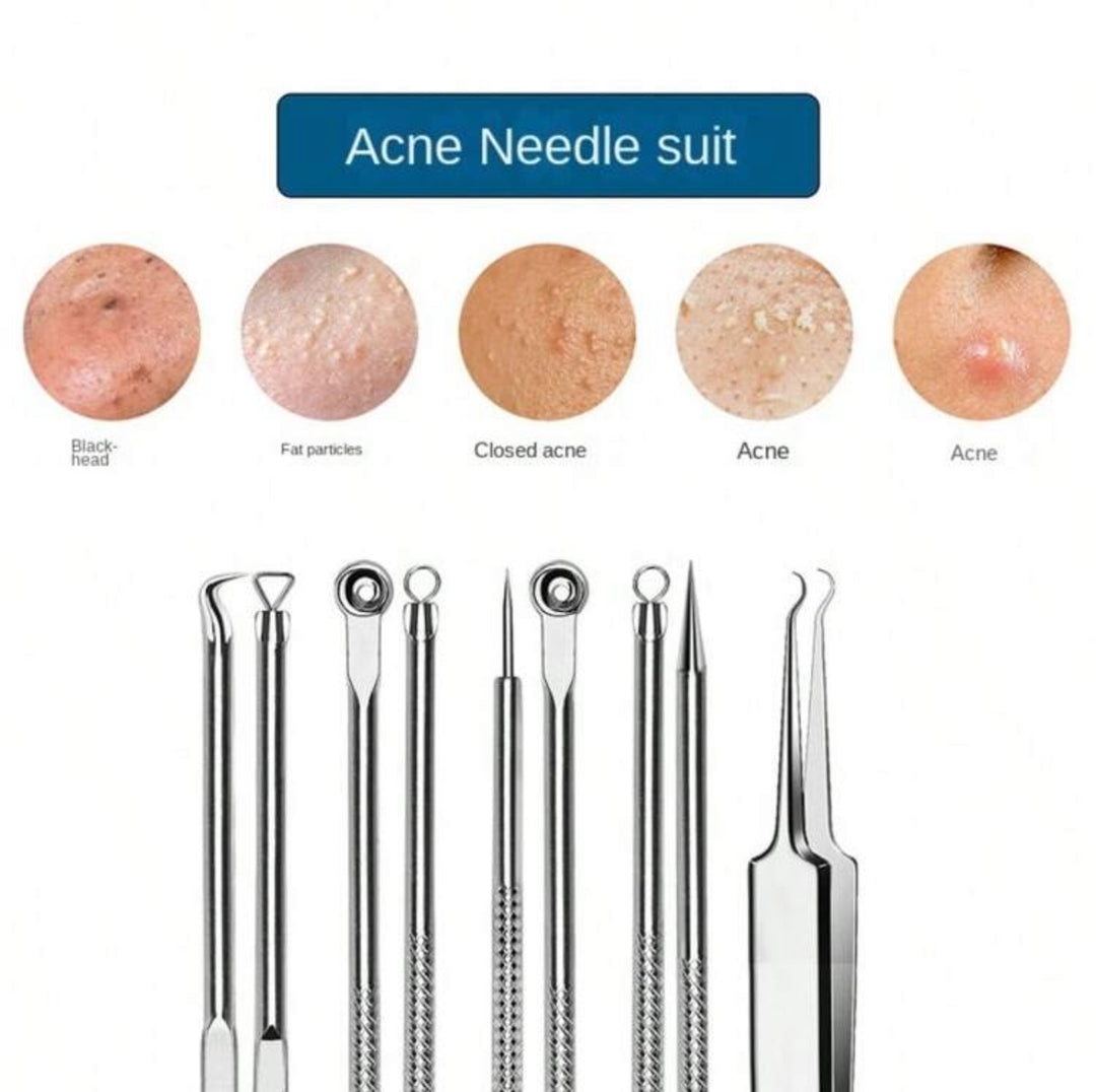 Blackhead Removal Tools set - 4pcs | مجموعة أدوات إزالة الرؤوس السوداء – 4 قطع