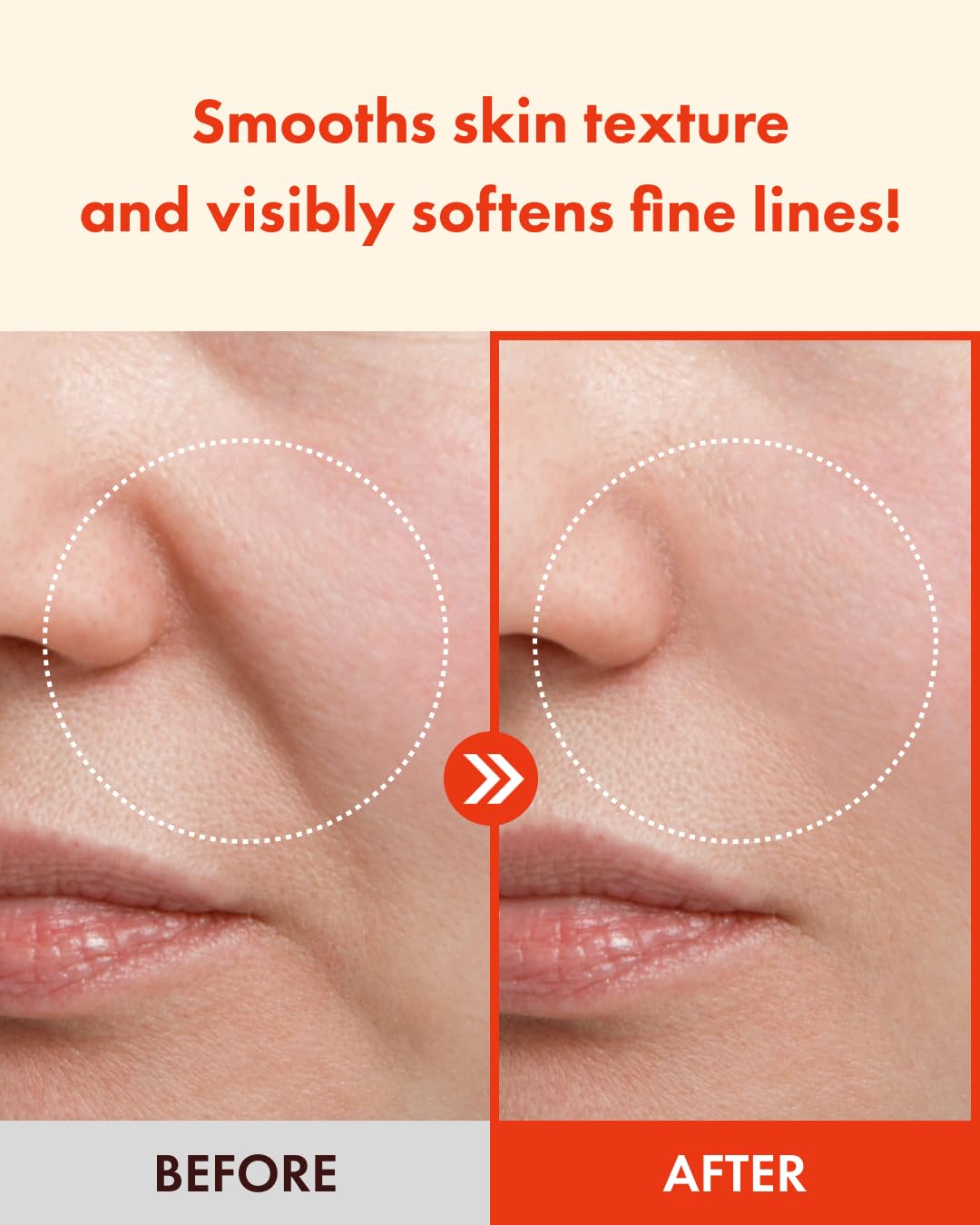 It'S SKIN Retinoidin Serum mit Retinoid & Peptiden - 30ml | اتس سكين سيروم الريتينول والببتيدين - 30 مل