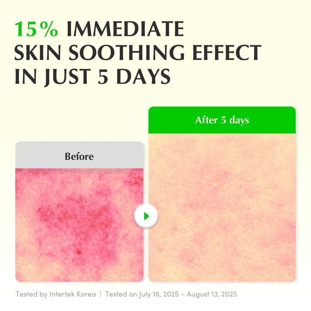 EQQUAL BERRY Green Aid Aloe PDRN Calming Serum - 30ml | إي كوال بيري سيروم مهدئ جرين إيد بالألوفيرا – 30 مل