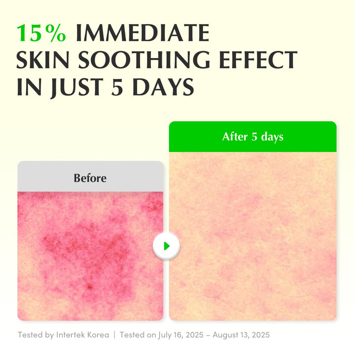 EQQUAL BERRY Green Aid Aloe PDRN Calming Serum - 30ml | إي كوال بيري سيروم مهدئ جرين إيد بالألوفيرا – 30 مل