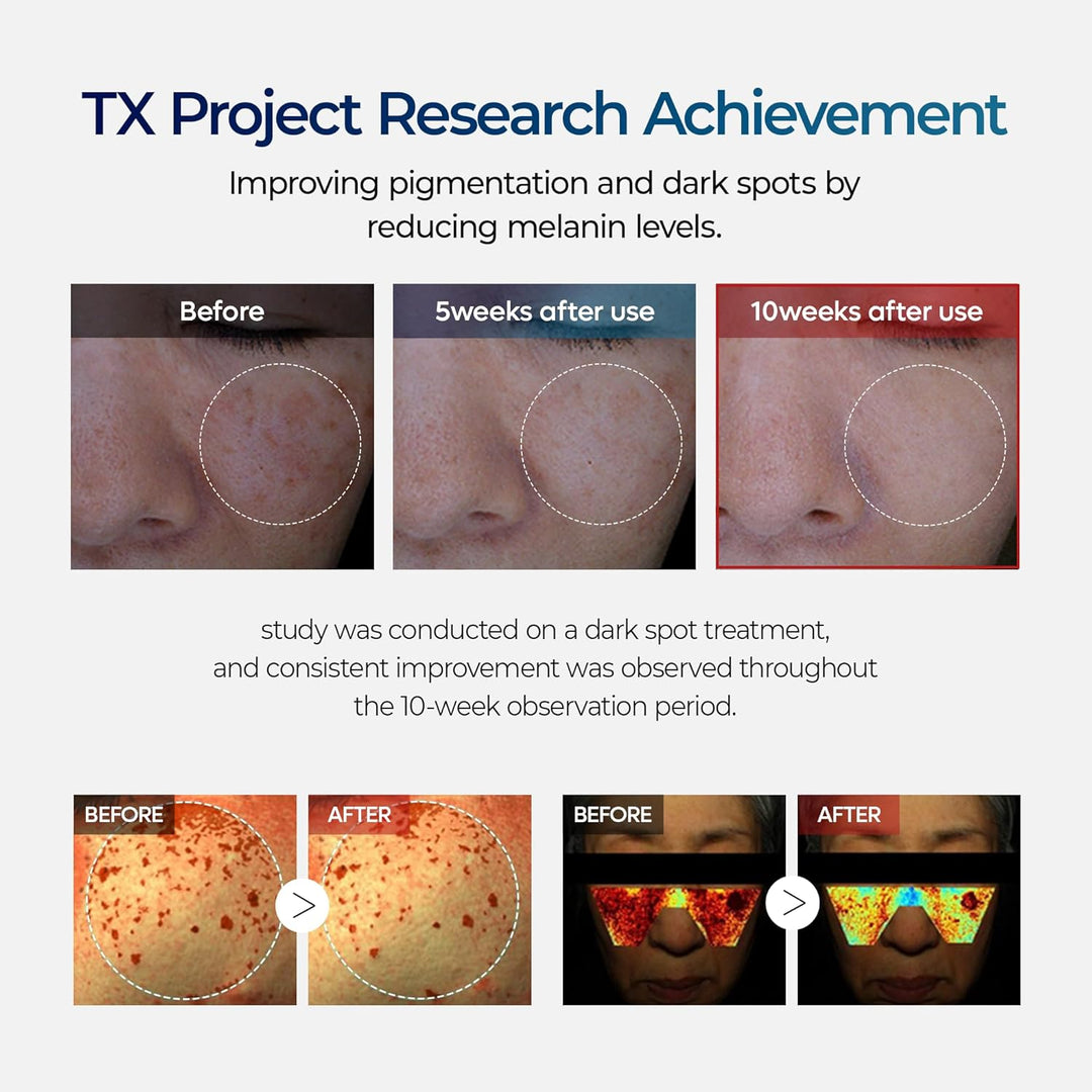 Dr.Melaxin TX Cream - 50g| د. ميلاكسن كريم لتفتيح وتوحيد لون البشرة – 50 غرام