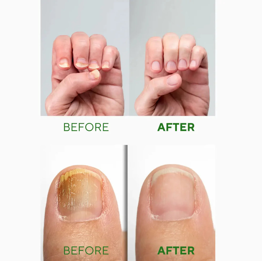 the CEEL Nail Repair Serum - 30ml | ذا سيل سيروم الاظافر - 30 مل