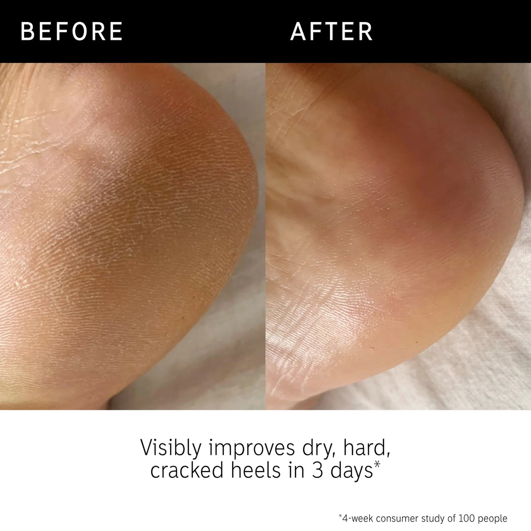 THE INKEY LIST Glycolic Acid Exfoliating Body Stick - 45g | ذا انكي ليست ستيك جليكوليك اسيد مقشرة للجسم - 45 غرام