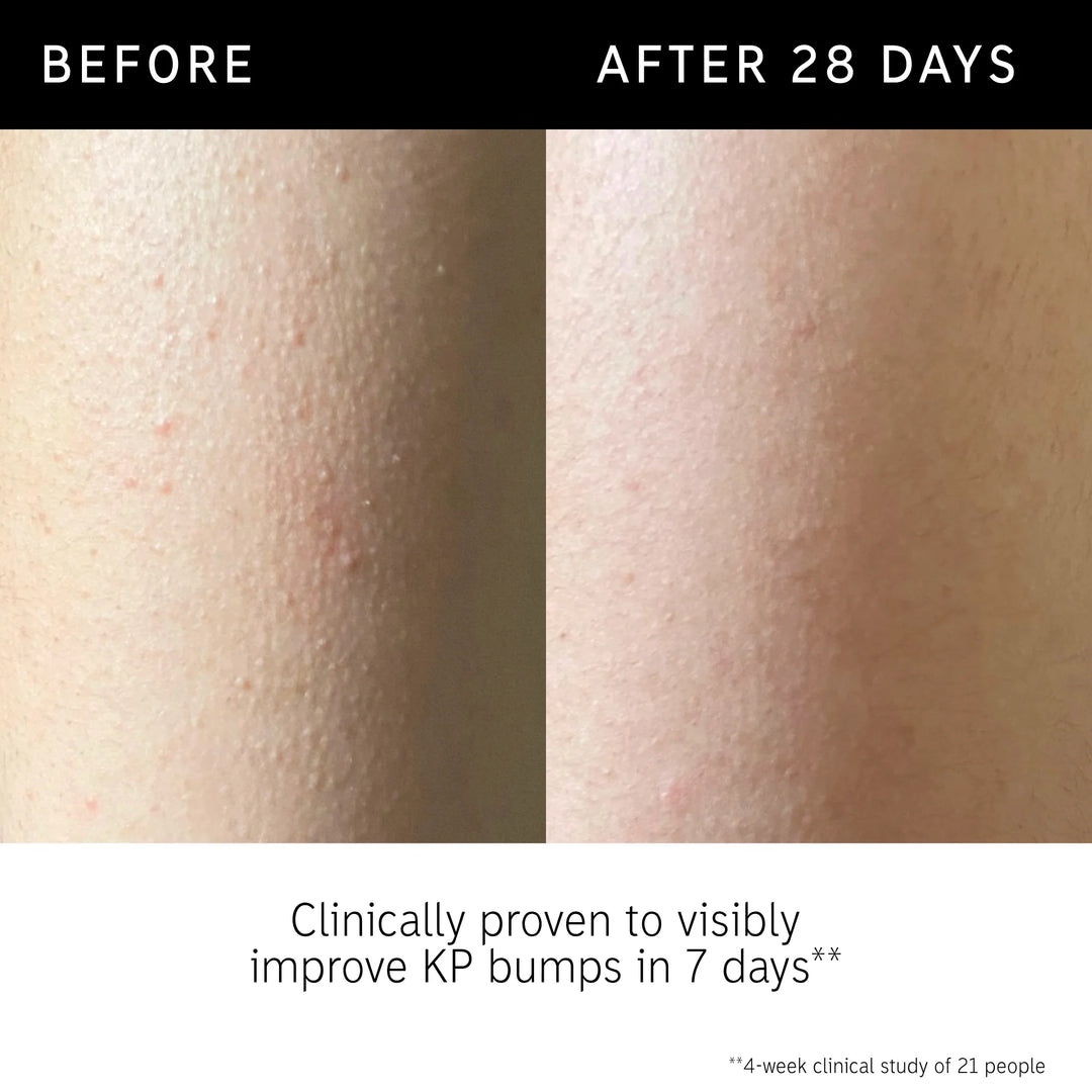 THE INKEY LIST Glycolic Acid Exfoliating Body Stick - 45g | ذا انكي ليست ستيك جليكوليك اسيد مقشرة للجسم - 45 غرام