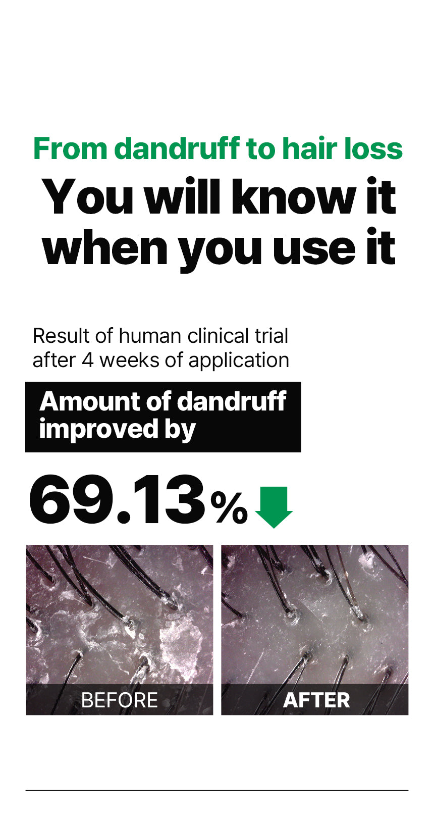 DR+ BANGGIWON Dandruff Shampoo Anti-Hair Loss - 500ml | د + بانجيون شامبو مضاد للقشرة و لتساقط الشعر - 500 مل