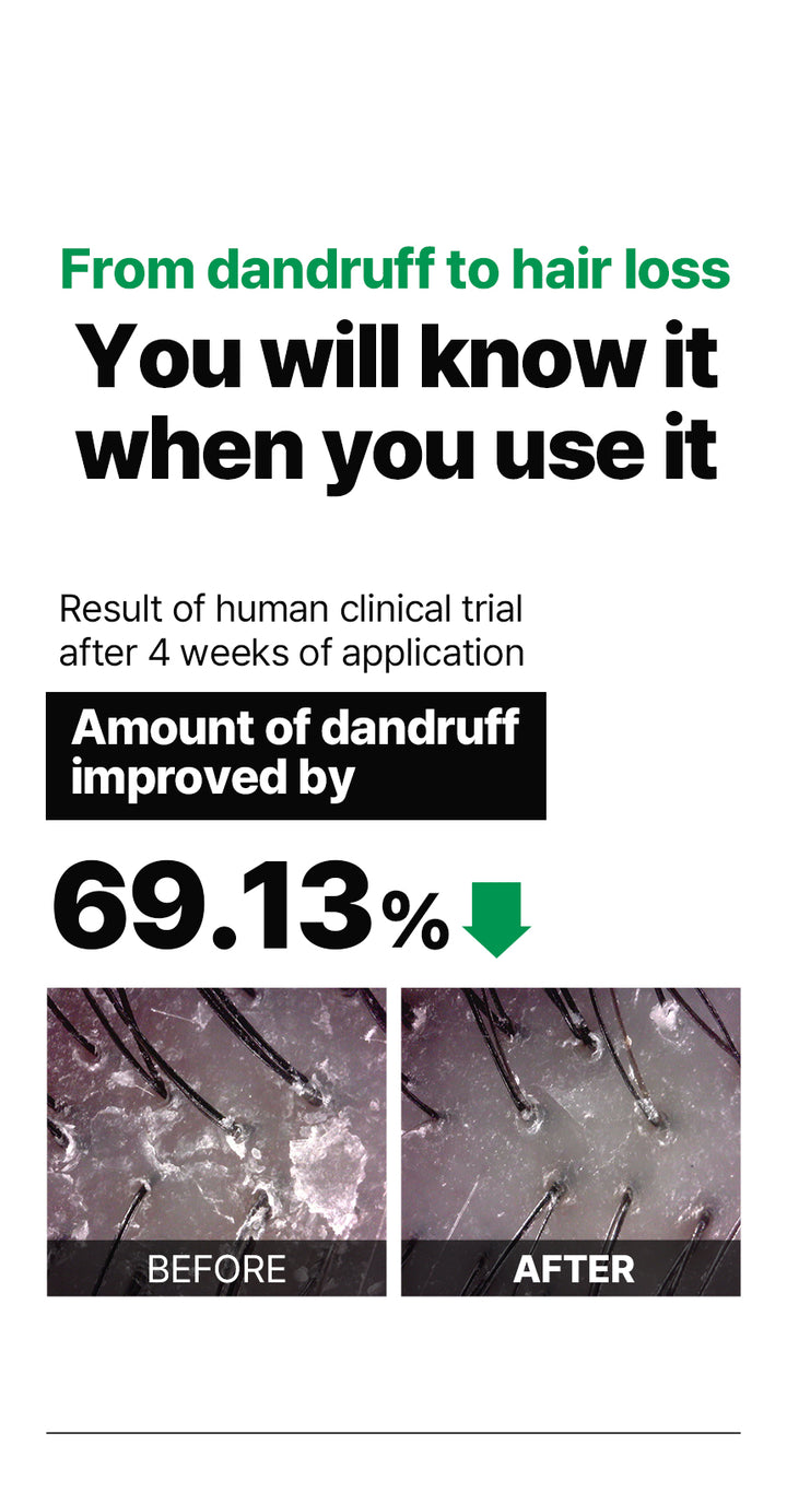 DR+ BANGGIWON Dandruff Shampoo Anti-Hair Loss - 500ml | د + بانجيون شامبو مضاد للقشرة و لتساقط الشعر - 500 مل