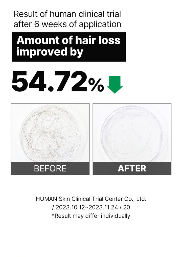DR+ BANGGIWON Dandruff Shampoo Anti-Hair Loss - 500ml | د + بانجيون شامبو مضاد للقشرة و لتساقط الشعر - 500 مل
