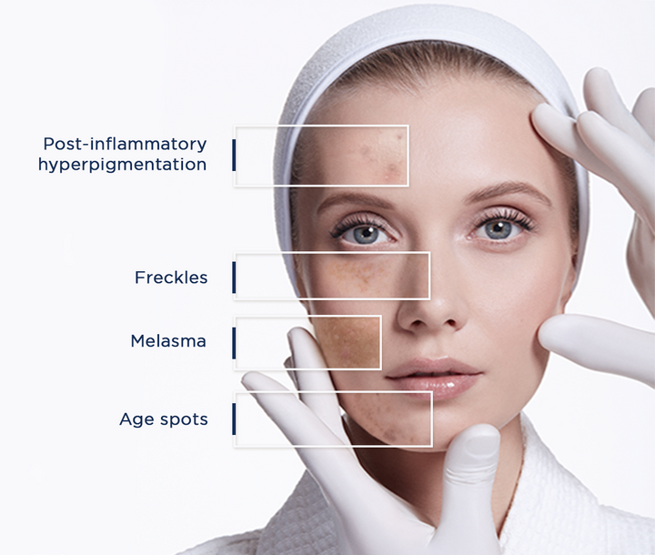 RILASTIL D-Clar Depigmenting Concentrate Drops - 30ml | ريلاستيل سيروم مركز لعلاج التصبغات - 30 مل
