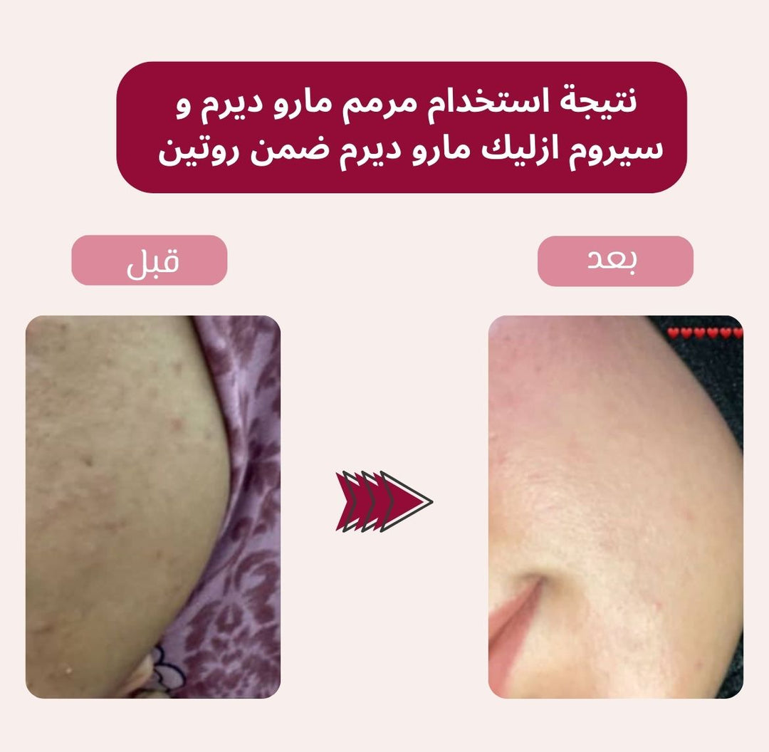 maru.derm Repairing & Strengthening Barrier Cream - 200ml | مارو ديرم كريم مرمم و مقوي للبشرة - 200 مل