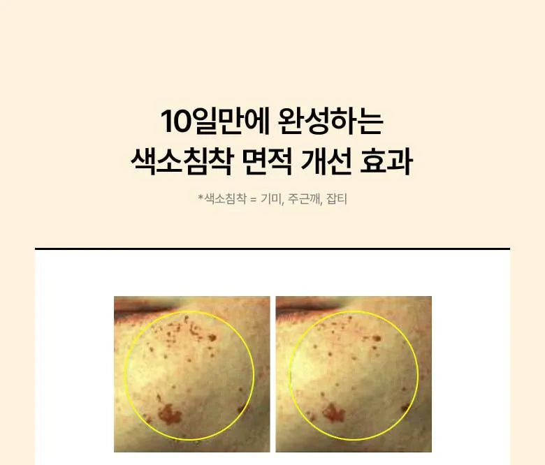 Anua - Vitamin C Niacin Tone Up Blemish Pad - 185ml | أنوا وسادادت تونر بالنياسيناميد و فيتامين سي - 185 مل