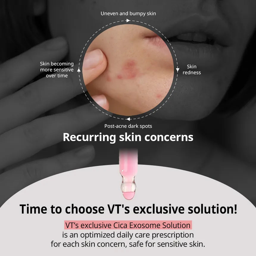 VT Cosmetics Azelaic Acid Cica Exosome - 30ml | في تي كوزمتيك سيوم أزليك اسيد - 30 مل