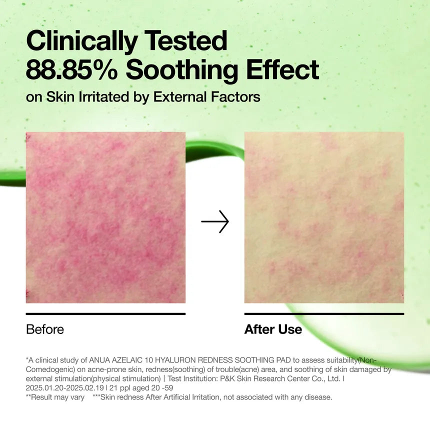 Anua Soothing Pad Azlaic10 + Hyaluron - 90pads | أنوا تونر بالأزليك اسيد و الهيالورونيك اسيد - 90 قطعة
