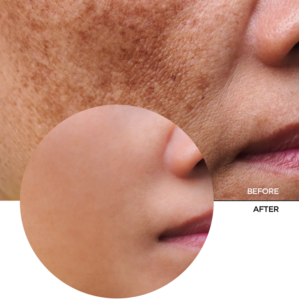 REVOX Just Mandelic Acid 10%+HA Mild Exfoliation - 30ml | ريفوكس سيروم الماندليك اسيد 10% + هيالورونيك اسيد - 30 مل