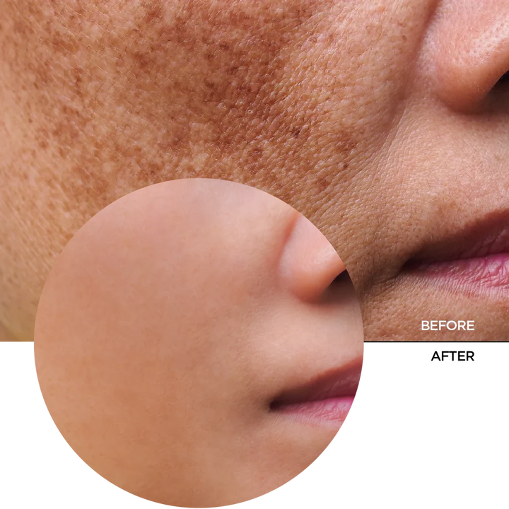 REVOX Just Mandelic Acid 10%+HA Mild Exfoliation - 30ml | ريفوكس سيروم الماندليك اسيد 10% + هيالورونيك اسيد - 30 مل