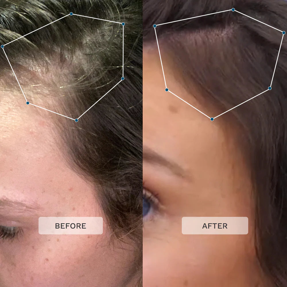 Hairburst Multi-Active Scalp Serum - 60ml | هيربيرست سيروم لفروة الرأس لتحفيز نمو الشعر - 60 مل