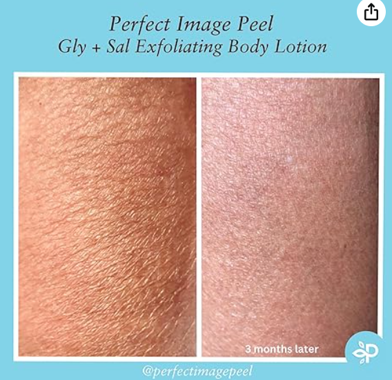 Perfect Image Gly + Sal Exfoliating Body Lotion - 240ml |  بيرفكت إيمج لوشن ساليسيليك + غليكوليك اسيد للجسم - 240 مل