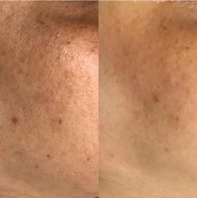 Perfect Image Hydro-Glo Peel Pads Tone - 30Pads | بيرفيكت ايمج هايدرو جل قناع التقشير - 30 قطعة