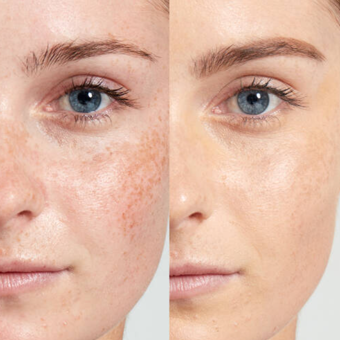 NYX HD Studio Photogenic Concealer - 3g | ان واي اكس كونسيلر - 3 غرام