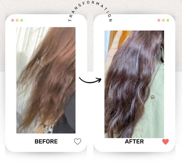 RW Anti Hair Loss Shampoo - 250ml | رو شامبو مضاد لتساقط الشعر - 250 مل