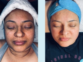 Perfect Image Pineapple Pumpkin Enzyme Peel - 30ml | بيرفكت إيمج سيروم مقشر بأنزيمات الفواكه - 30 مل