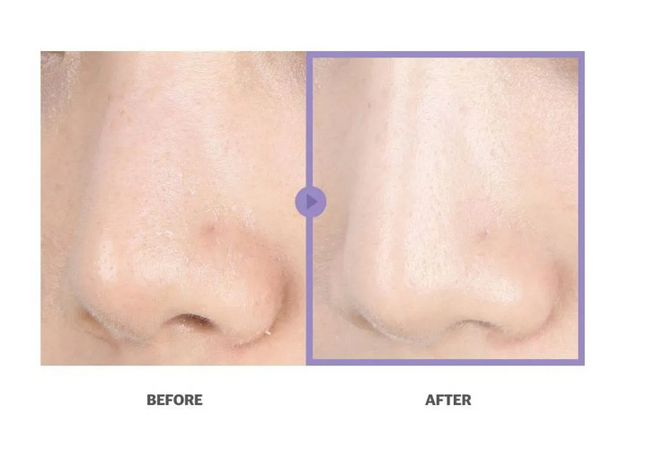 celimax Heartleaf Bha Peeling Pad - 60pcs | سيليماكس وسادات تونر مقشرة بحمض ال BHA - 60 قطعة