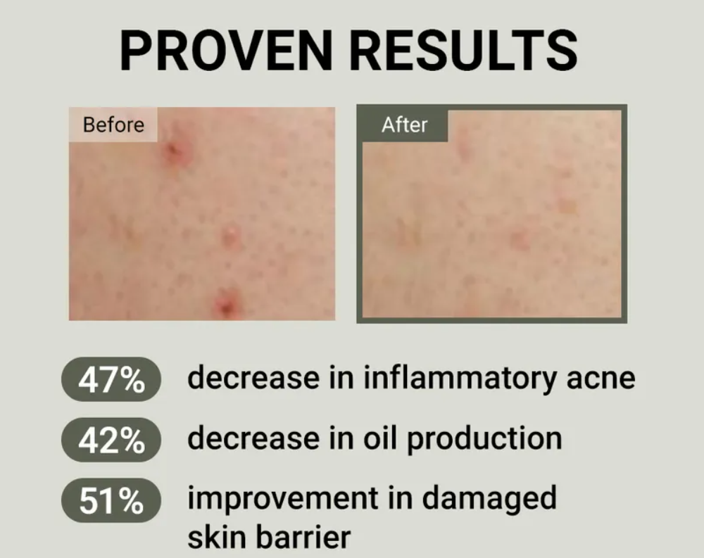 JUMISO Snail Mucin 88 + Peptide Facial Cream - 100ml | جوميسو كريم مرطب بمستخلص الحلزون + ببتيدات - 100 مل