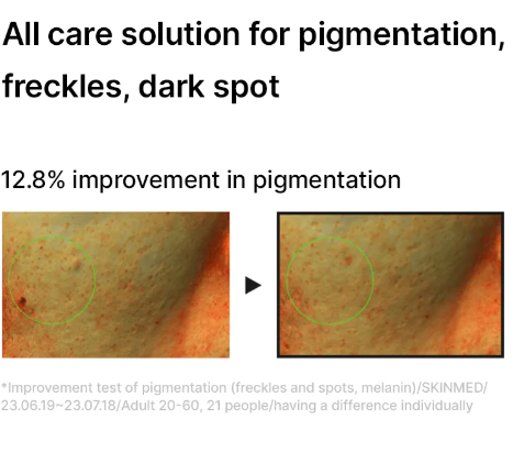 celimax Pore + Dark Spot Brightening Serum - 30ml | سيليماكس سيروم مضاد للتصبغات و المسام - 30 مل