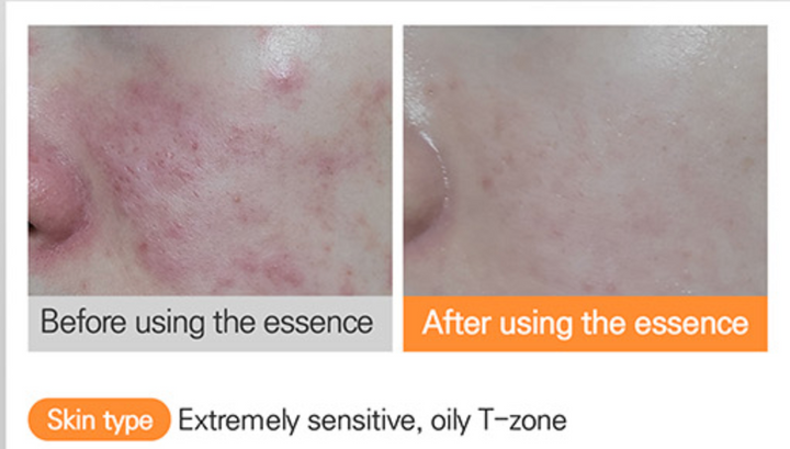 HYAAH Licorice First Essence - 200ml | هيا ايسنس عرق السوس - ٢٠٠ مل
