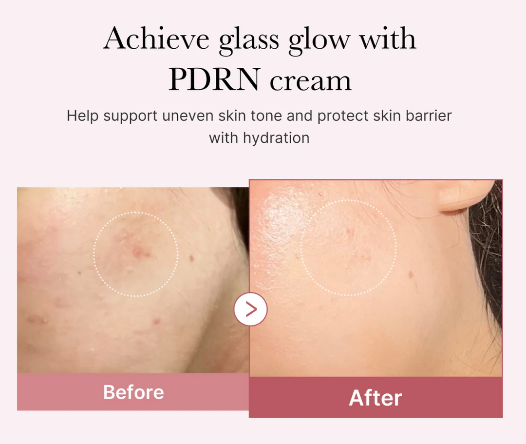 Medicube PDRN PINK HYALURONIC MOISTURIZING CREAM - 50ML | ميدي كيوب كريم مرطب بالهيالورونيك اسيد - ٥٠ مل
