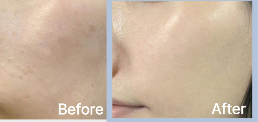 celimax Dual Barrier Cream - 50ml | سيليماكس كريم مرمم لحاجز البشرة - 50 مل