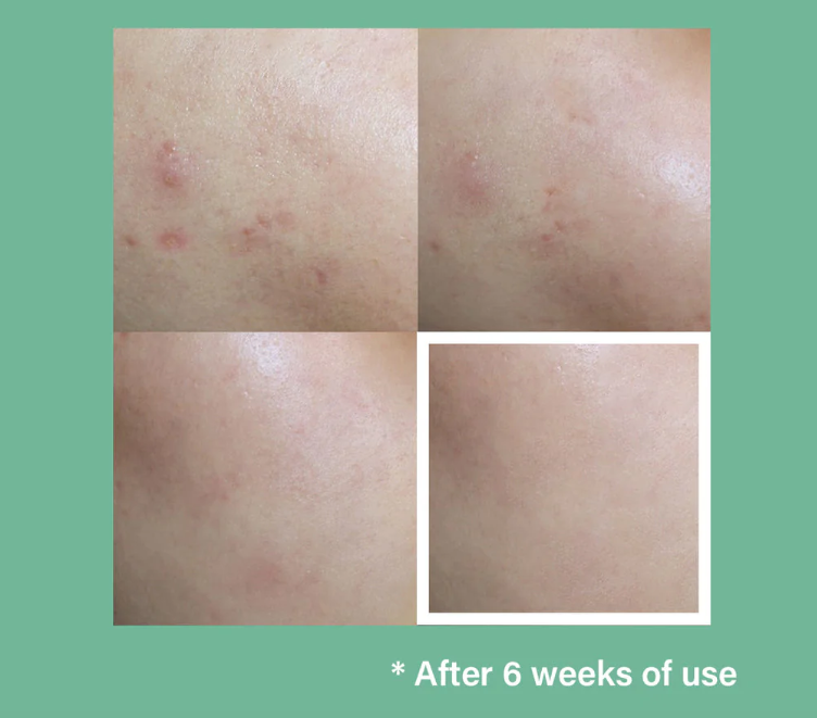 celimax The Real Cica Niacinamide AC Calming Serum - 40ml | سيليماكس سيروم السينتيلا و النياسيناميد لتهدئة البشرة - 40 مل