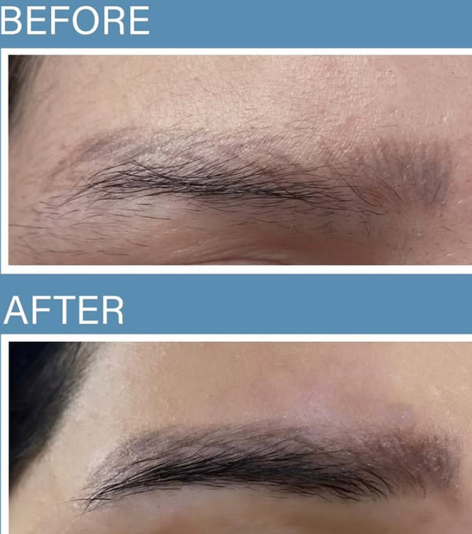 AYTEN Eyebrow Serum - 5ml | ايتن سيروم للحواجب - 5 مل