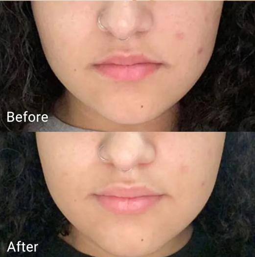 APRILSKIN Real Calendula Peel Off Pack - 100g
