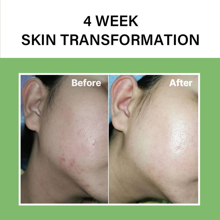 celimax Noni Ampoule Calming + Radiance - 30ml | سيليماكس أمبول مهدئ و مضيئ للبشرة بمستخلص النوني - 30 مل