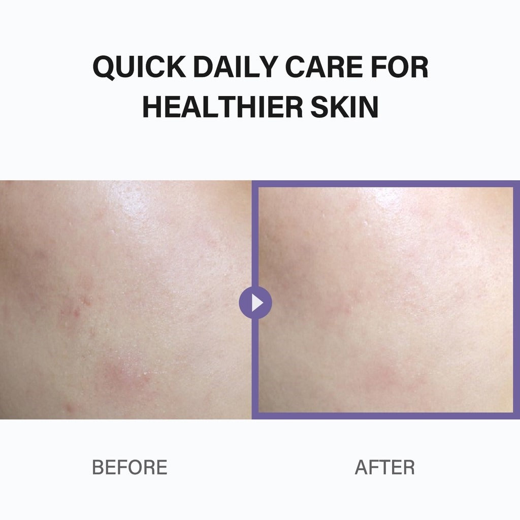 celimax Heartleaf Bha Peeling Pad - 60pcs | سيليماكس وسادات تونر مقشرة بحمض ال BHA - 60 قطعة