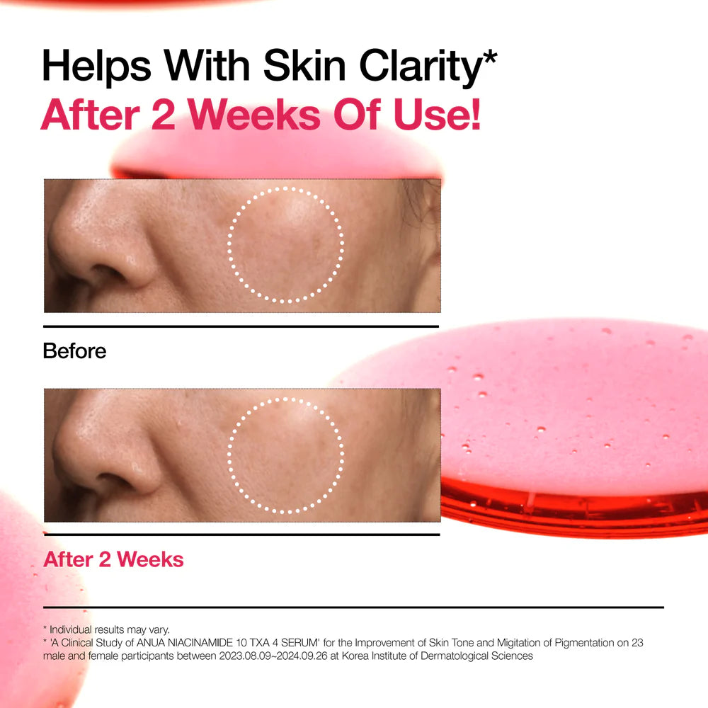 Anua Niacinamide 10% + TXA 4% Serum - 30ml | أنوا سيروم النياسيناميد 10% + ترانيكساميك اسيد 4% - 30 مل