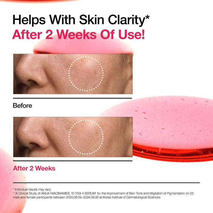 Anua Niacinamide 10% + TXA 4% Serum - 30ml | أنوا سيروم النياسيناميد 10% + ترانيكساميك اسيد 4% - 30 مل